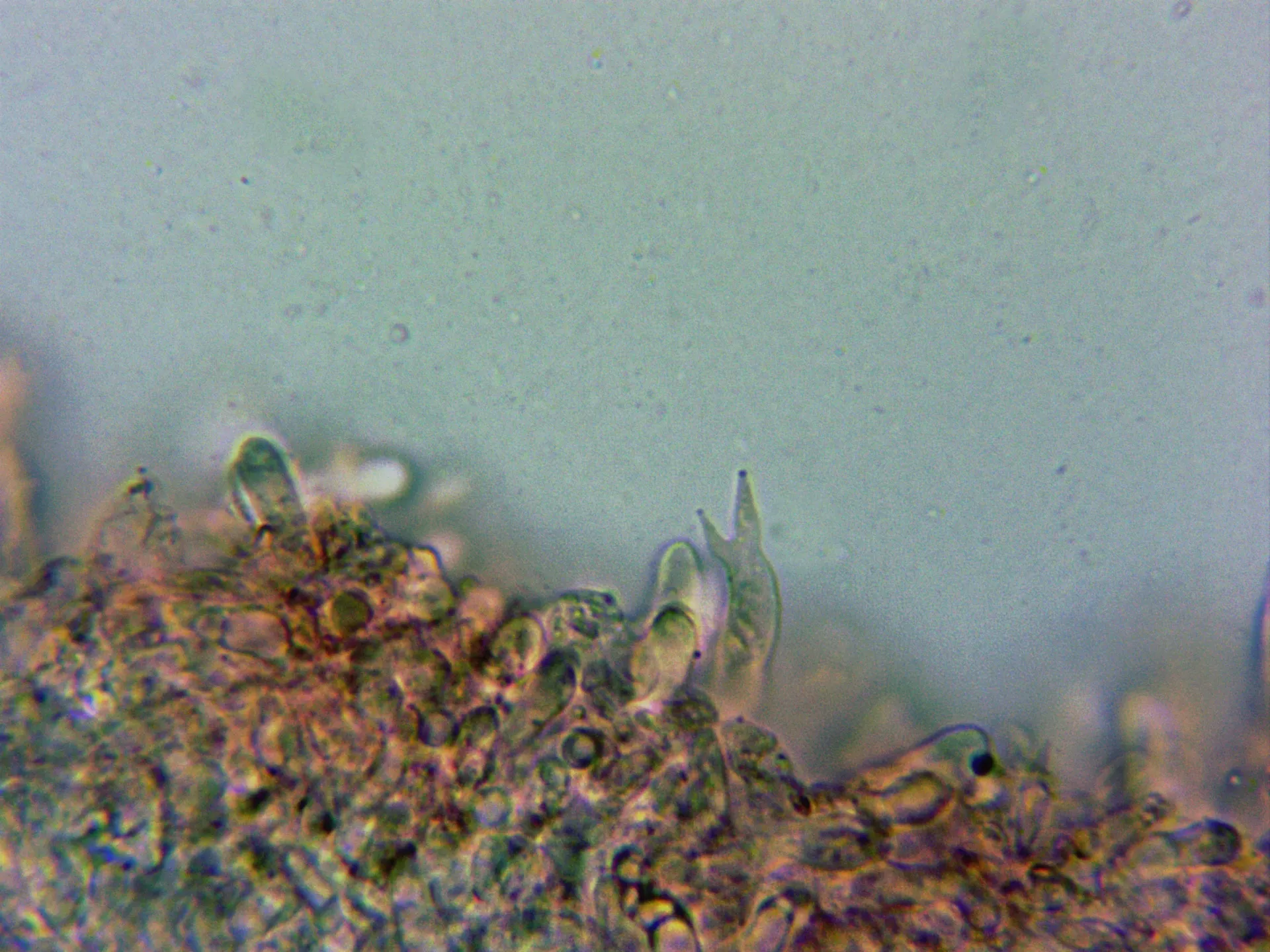 Microscopía de Omphalina subhepatica - 10 - Basidio bisporico arista